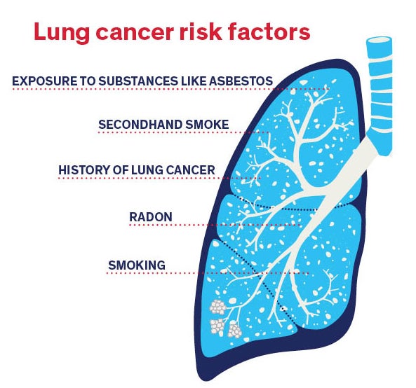 Lung Cancer